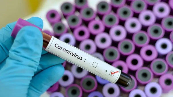 أول لقاح تجريبي ضد فيروس كورونا